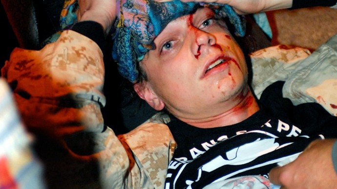 In this Oct. 25, 2011 file photo, 24-year-old Iraq War veteran Scott Olsen lies on the ground bleeding from a head wound after being struck by a projectile during an Occupy Wall Street protest in Oakland, Calif. Olsen, the Marine Corps veteran whose skull was fractured during the Occupy Oakland protest, was struck by a police beanbag round, not a tear gas canister as initially thought, his lawyer said on Monday, March 19, 2012. (AP Photo/Jay Finneburgh, File)