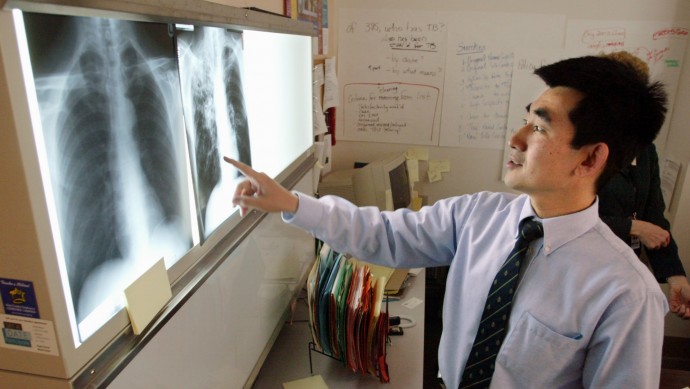 Dr. Masahiro Narita, medical director of the Seattle-King County Public Health Dept.'s tuberculosis clinic, looks over chest X-rays of patients infected with TB. (AP Photo/John Froschauer)