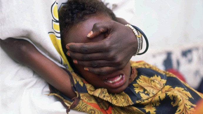 Hudan Mohammed Ali, 6, screams in pain while undergoing circumcision in Hargeisa, Somalia, June 17, 1996. Her sister Farhyia Mohammed Ali, 18, holds her so she cannot move. (AP Photo/Jean-Marc Bouju)